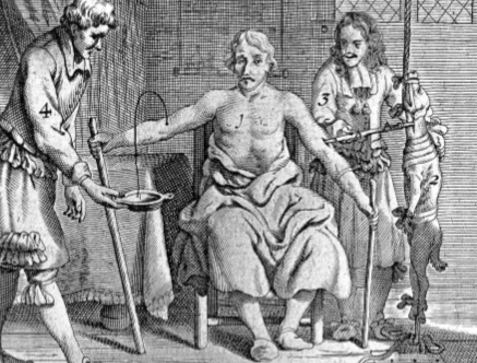 血色黎明：古代西方手术为何深陷放血迷雾